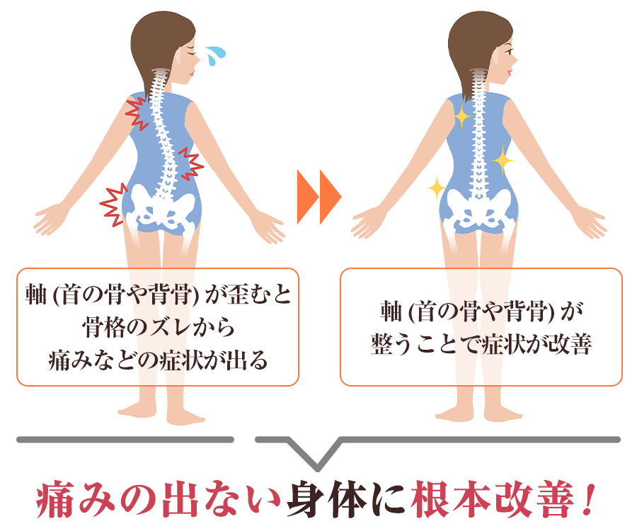 身体の歪みと改善のイメージ