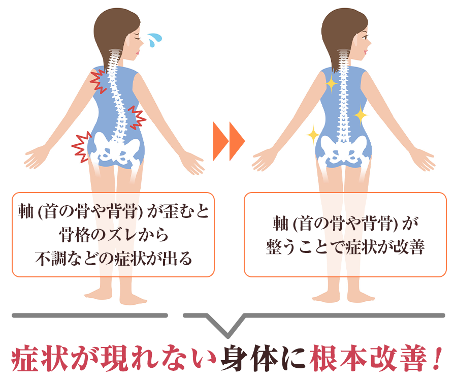 身体の歪みと改善のイメージ