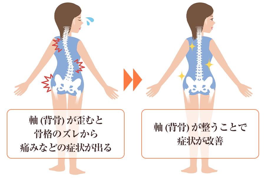 背骨のズレと改善のイメージ